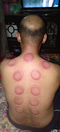 MIRACULOUS RESOURCES THERAPY AND HEALTHY - MyTerapi - Urut & Bekam Skudai, Johor Bahru
